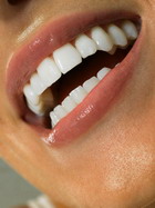 http://www.ivillage.ru/img/www/2/white-teeth.jpg