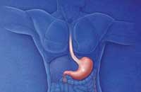 Хронический гастрит